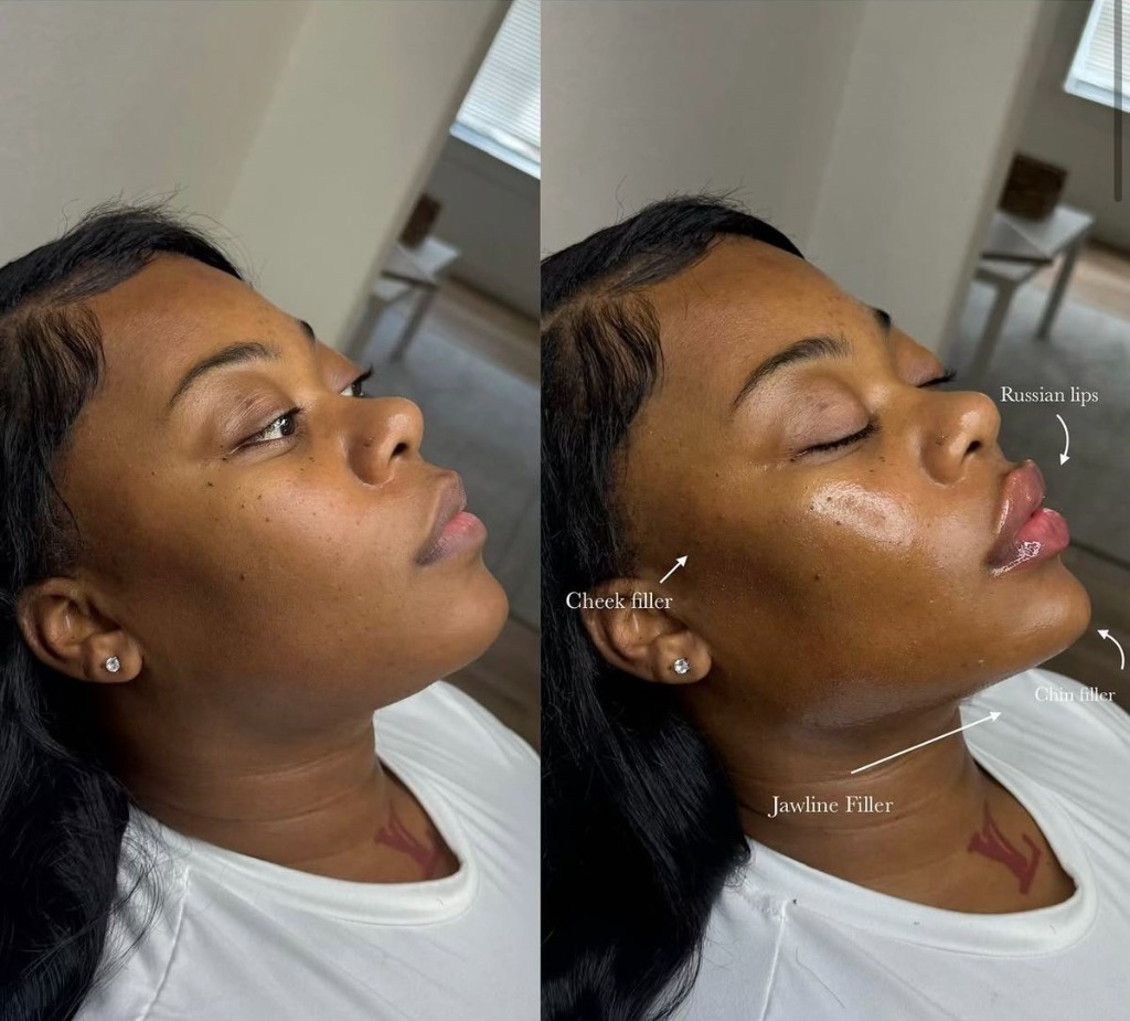Before and After Profile Balancing 2