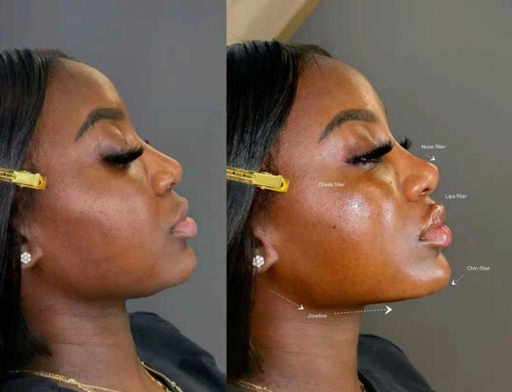 Before and After Profile Balancing 1